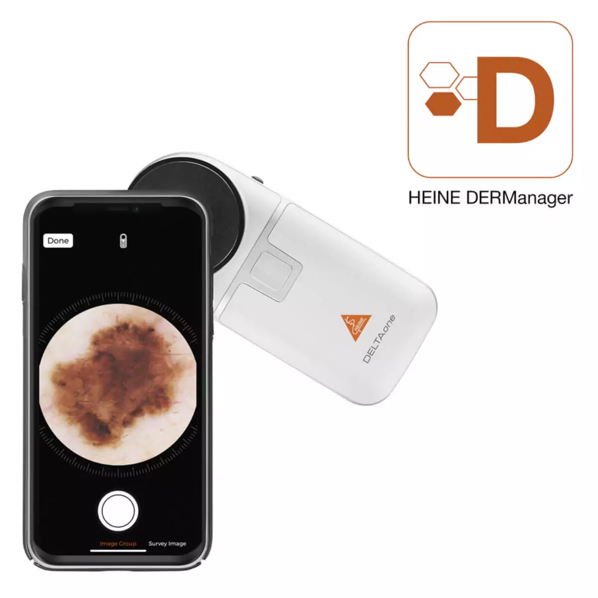  HEINE DELTAone Dermatoscoop