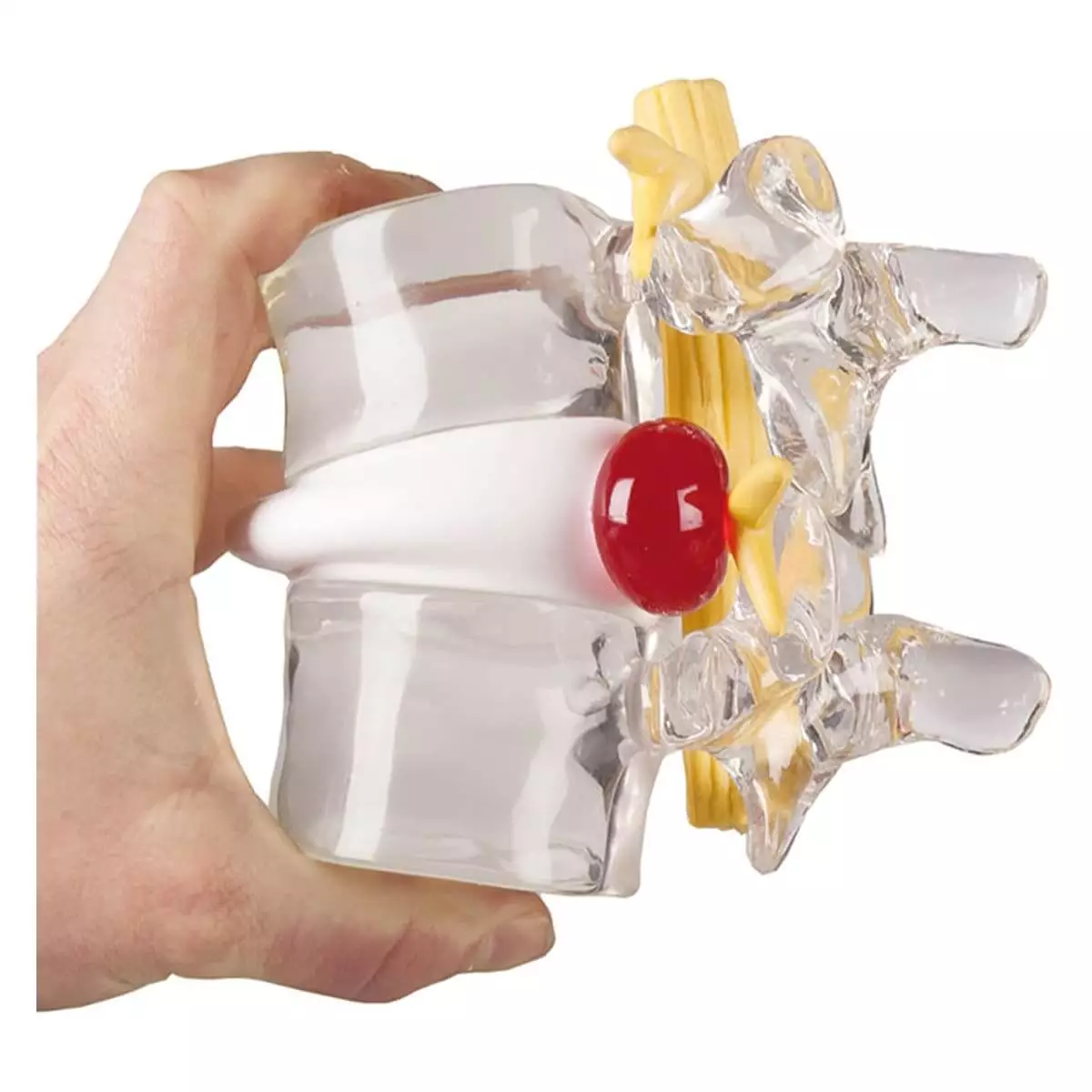  Hernia simulator