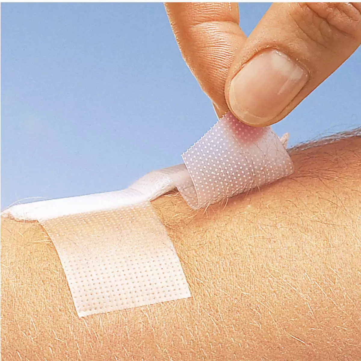  Omnifilm Fixatiepleister