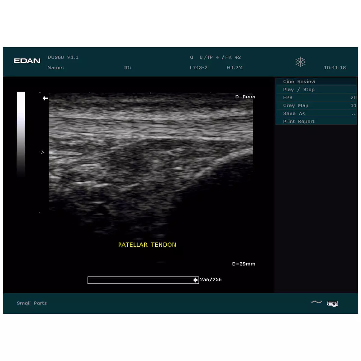  DUS 60 echografie scanner