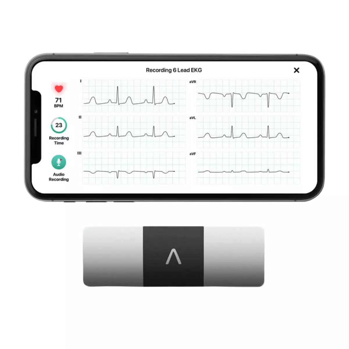  KardiaMobile® 6L Smartphone 6-Kanal-EKG