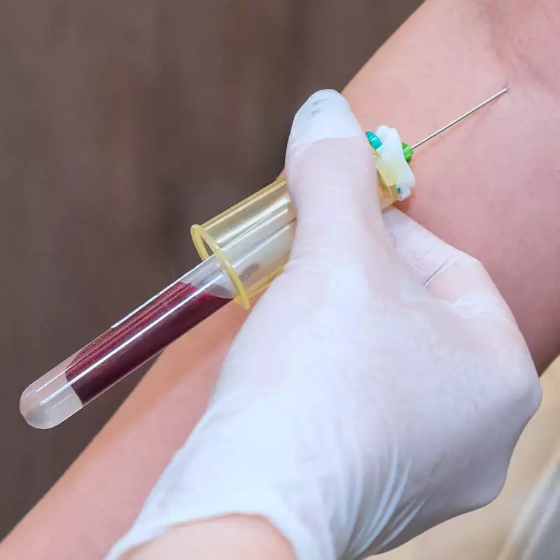 Kategorie 800x800 Blutentnahme Kategorie 800x800 Blutentnahme