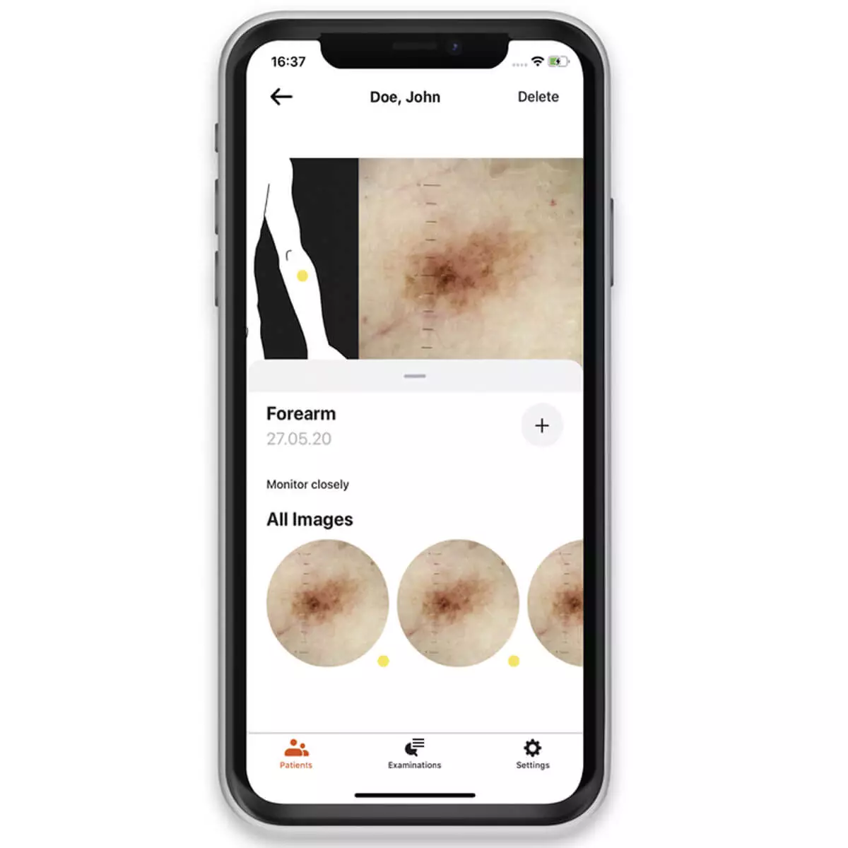  Coque d’adaptateur smartphone HEINE NC2