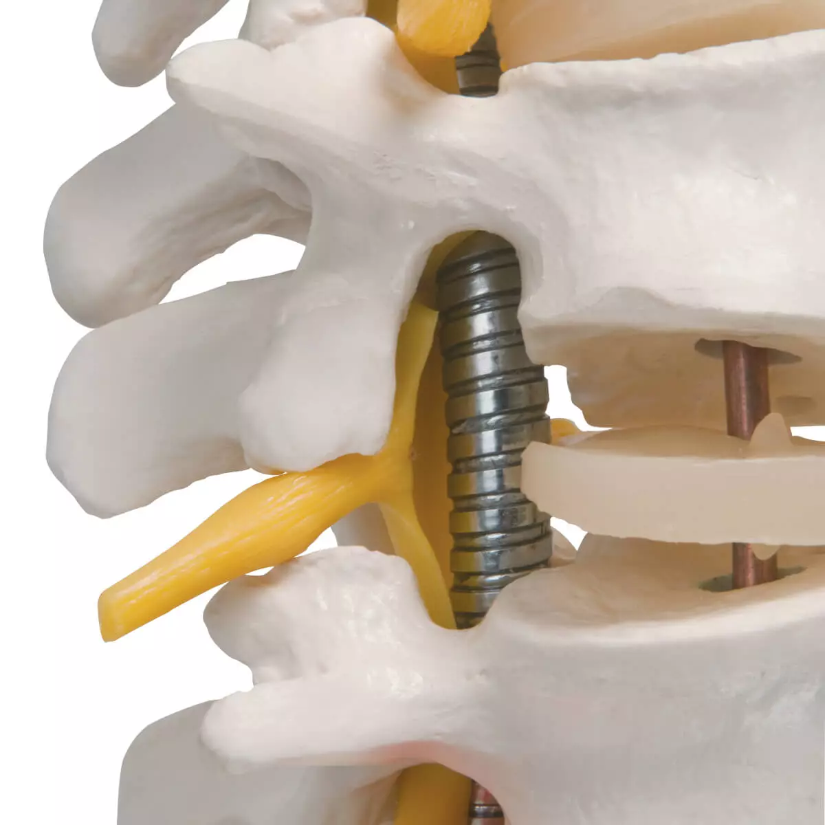  Flexibel wervelkolom model