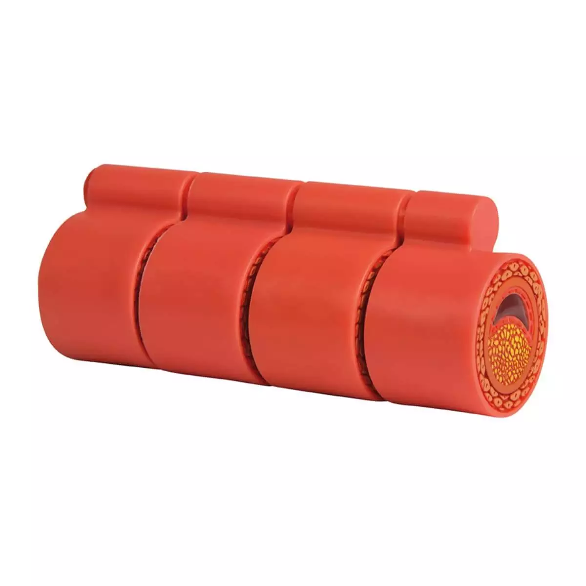  Modèle d'artériosclérose