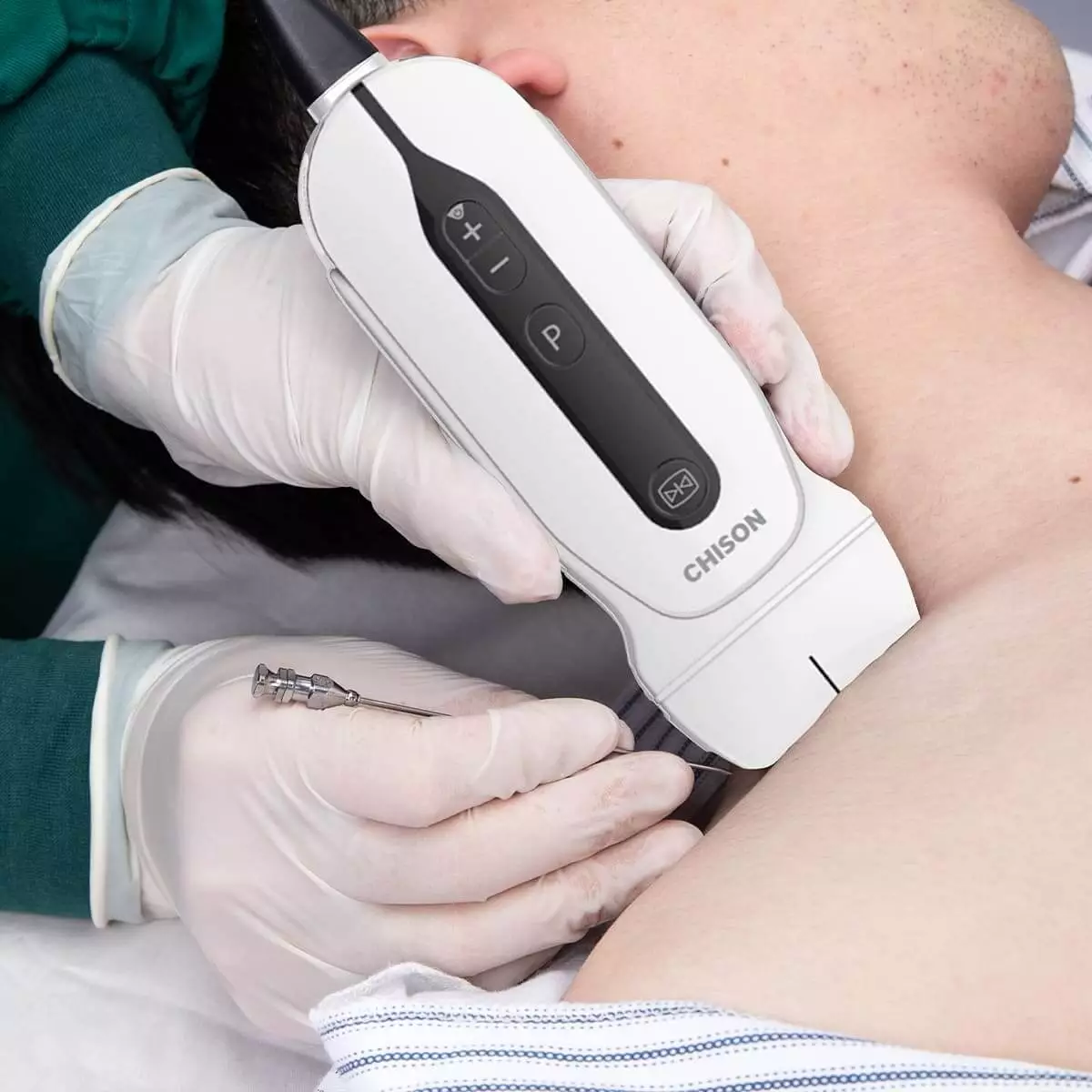  SonoEye G2 Handheld Ultrasound Scanner