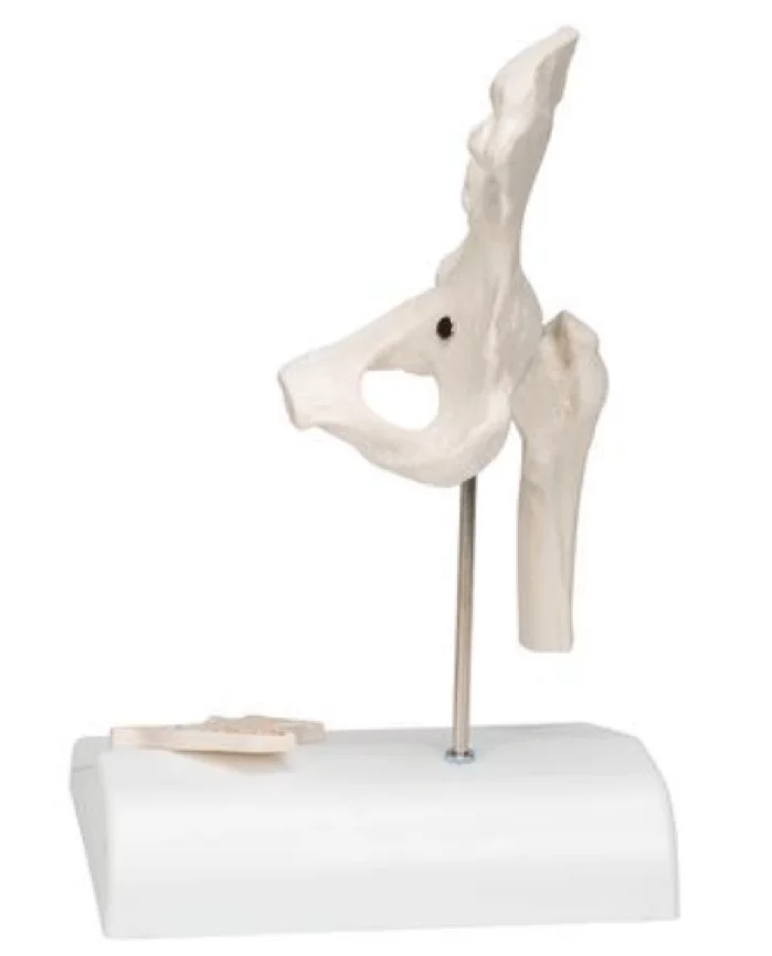  Mini model heupgewricht