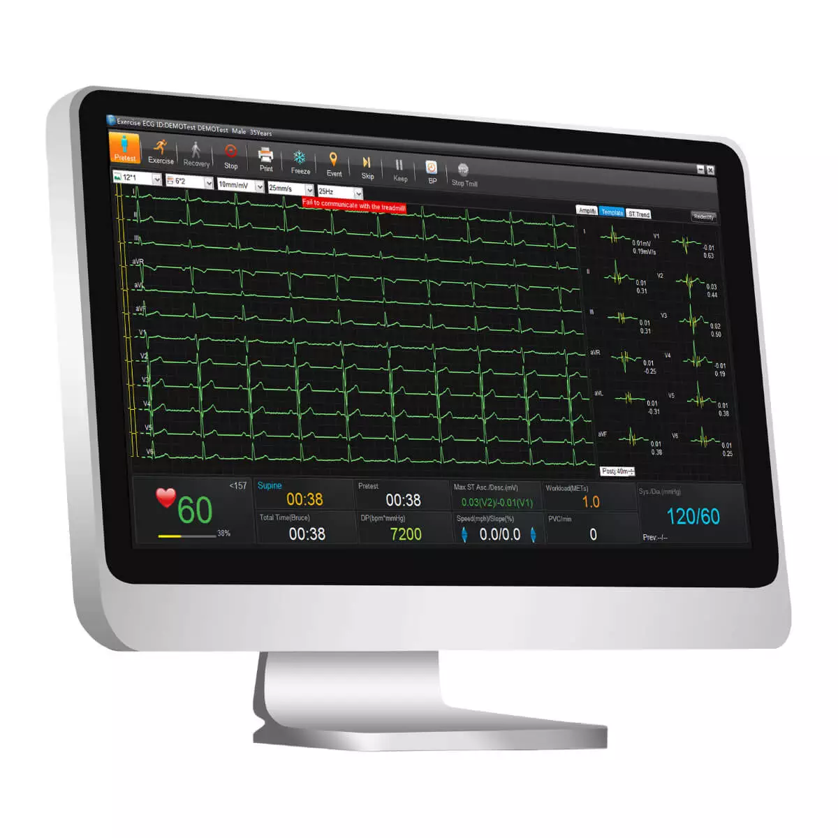  SE-1515 ECG-gegevensbeheersoftware