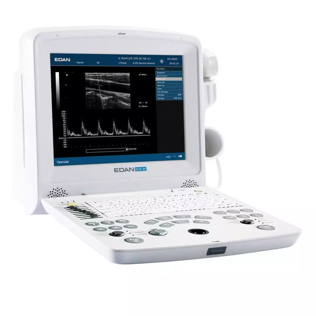  DUS 60 echografie scanner