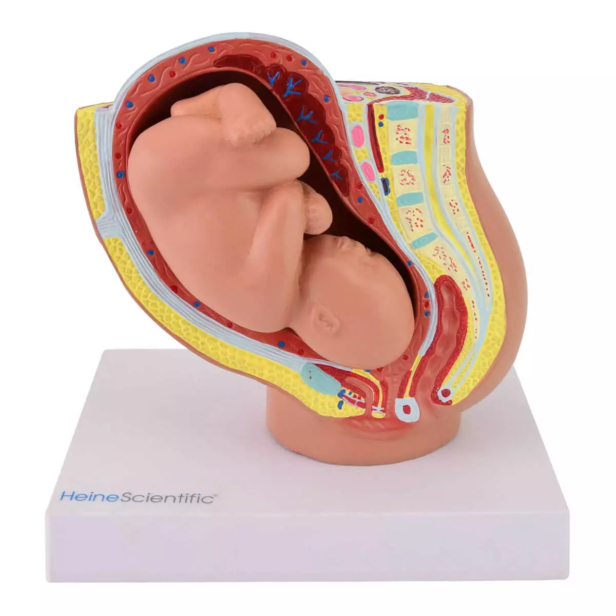  Miniatuurmodel bekken met foetus