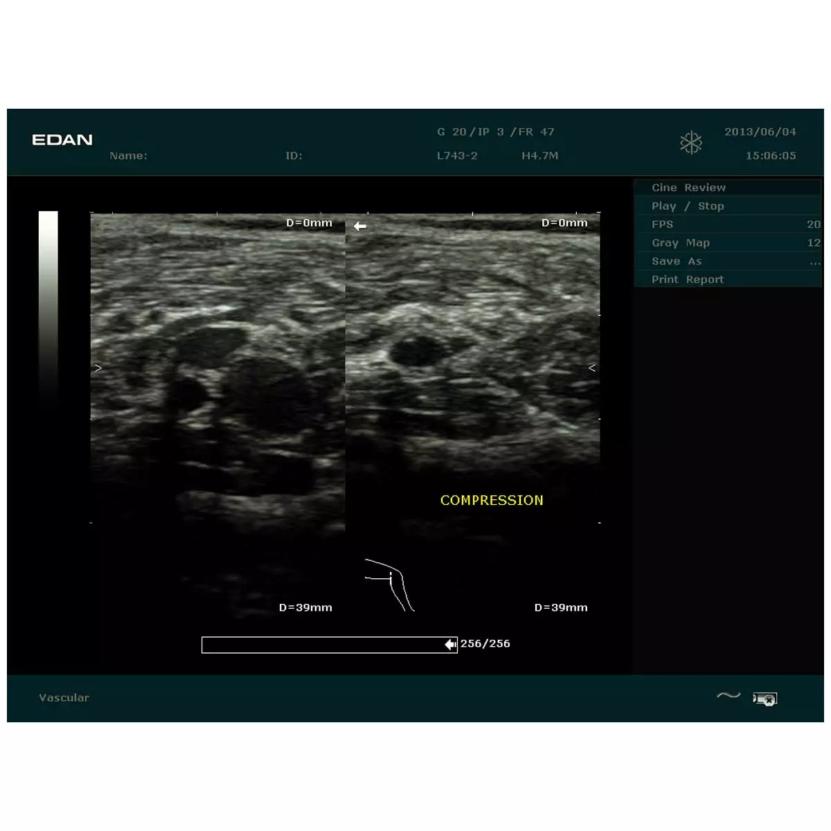 DUS 60 echografie scanner
