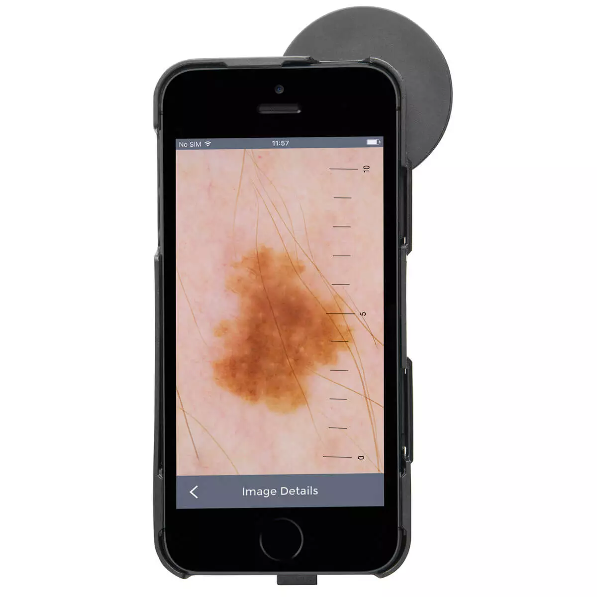  HEINE iC1 dermatoscoop