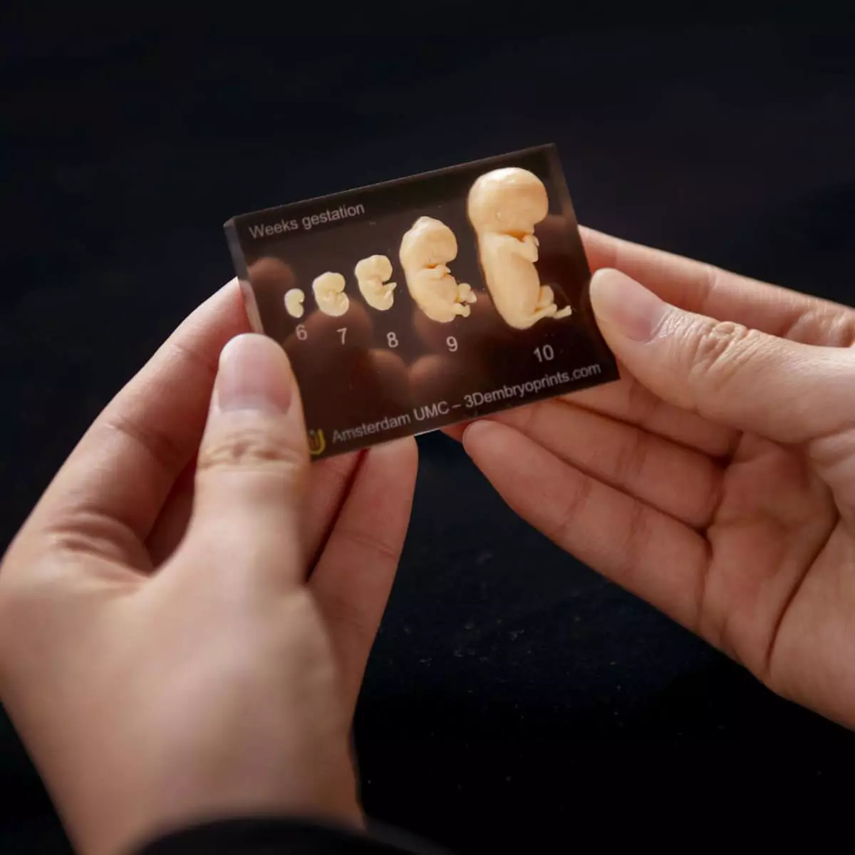  Embryomodellen 6e tot 10e week van zwangerschap