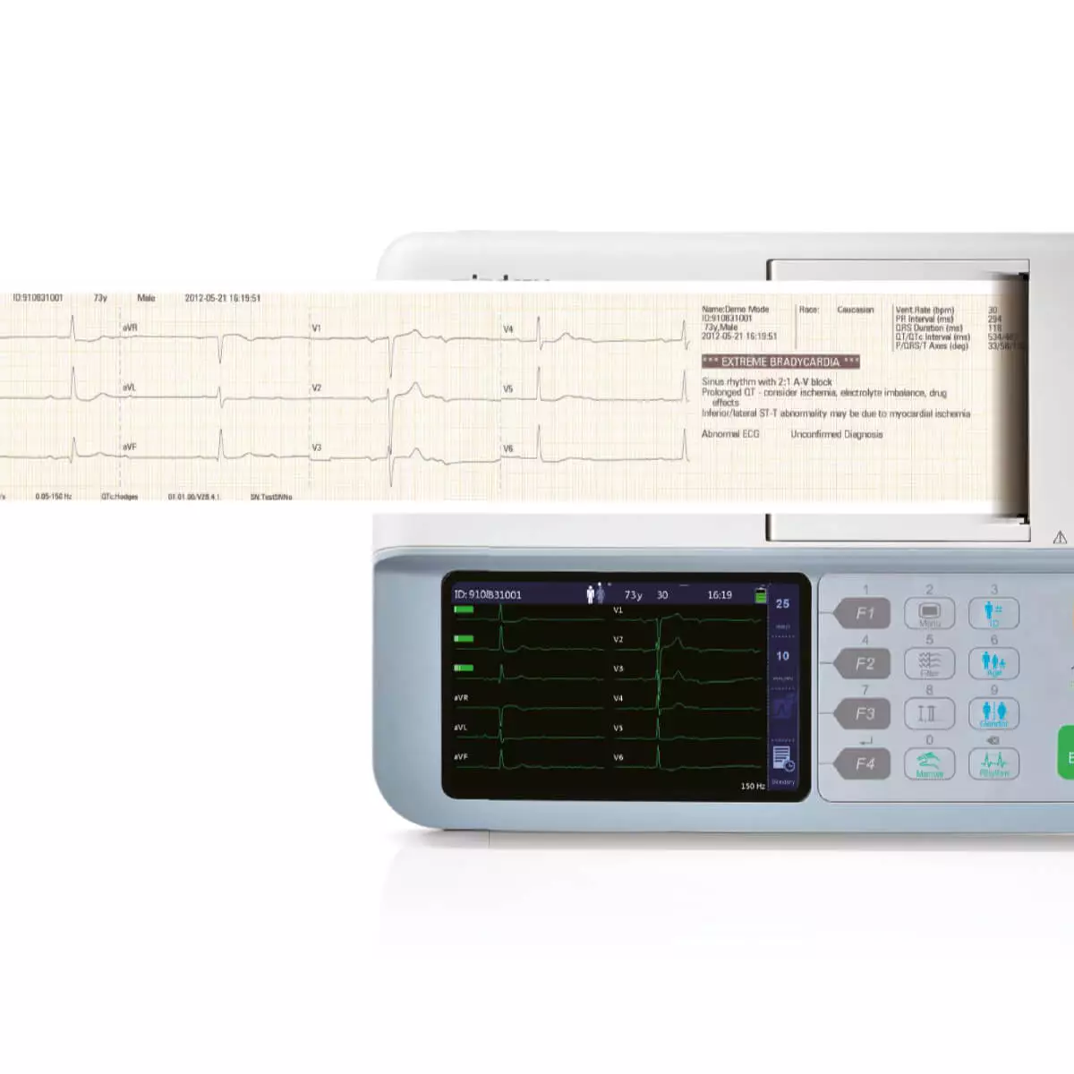 Électrocardiographe BeneHeart R3