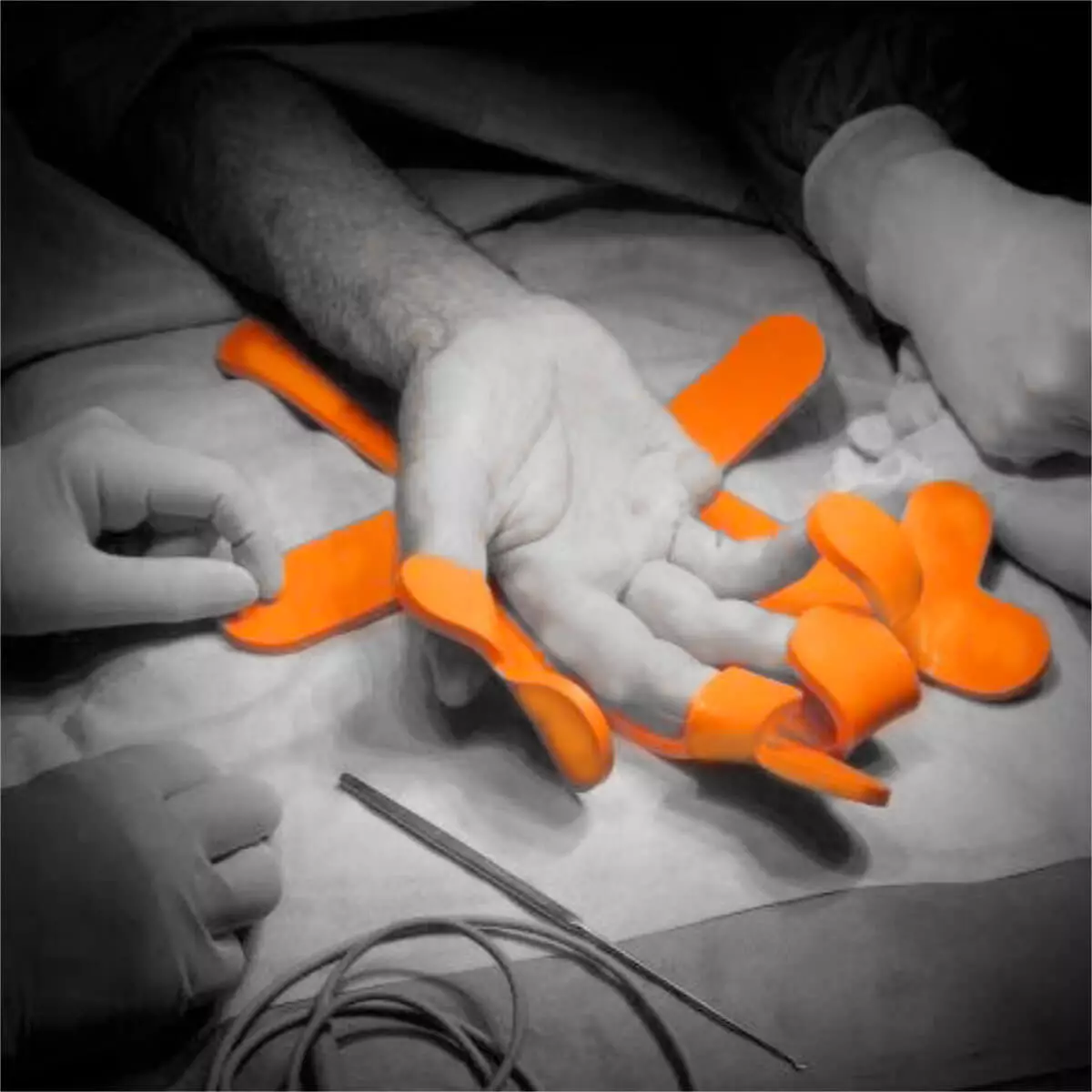 Stabilisateur chirurgical Mano Flexiblo Stabilisateur chirurgical Mano Flexiblo