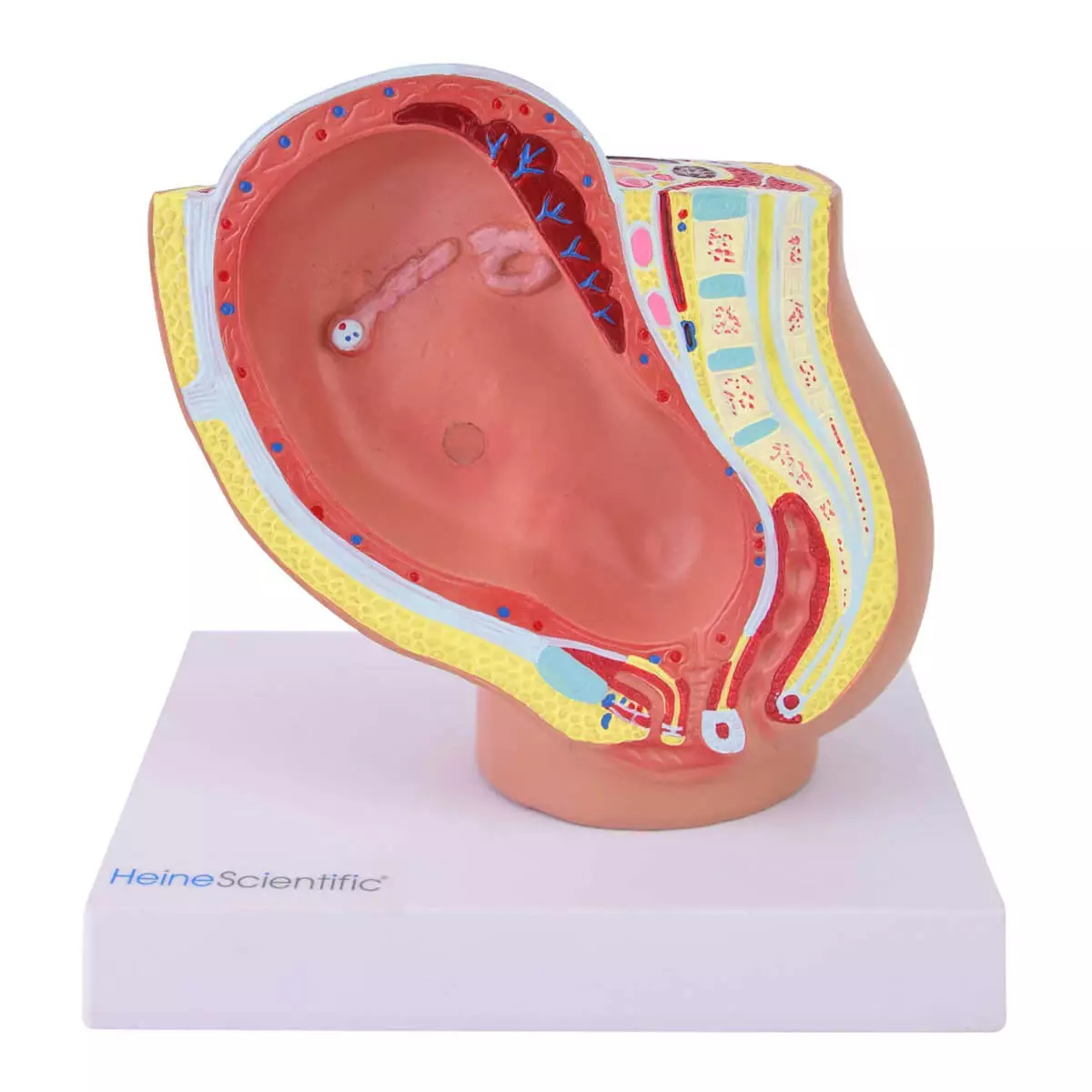  Miniatuurmodel bekken met foetus