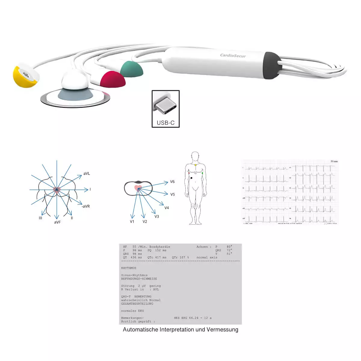  Système ECG CardioSecur Pro