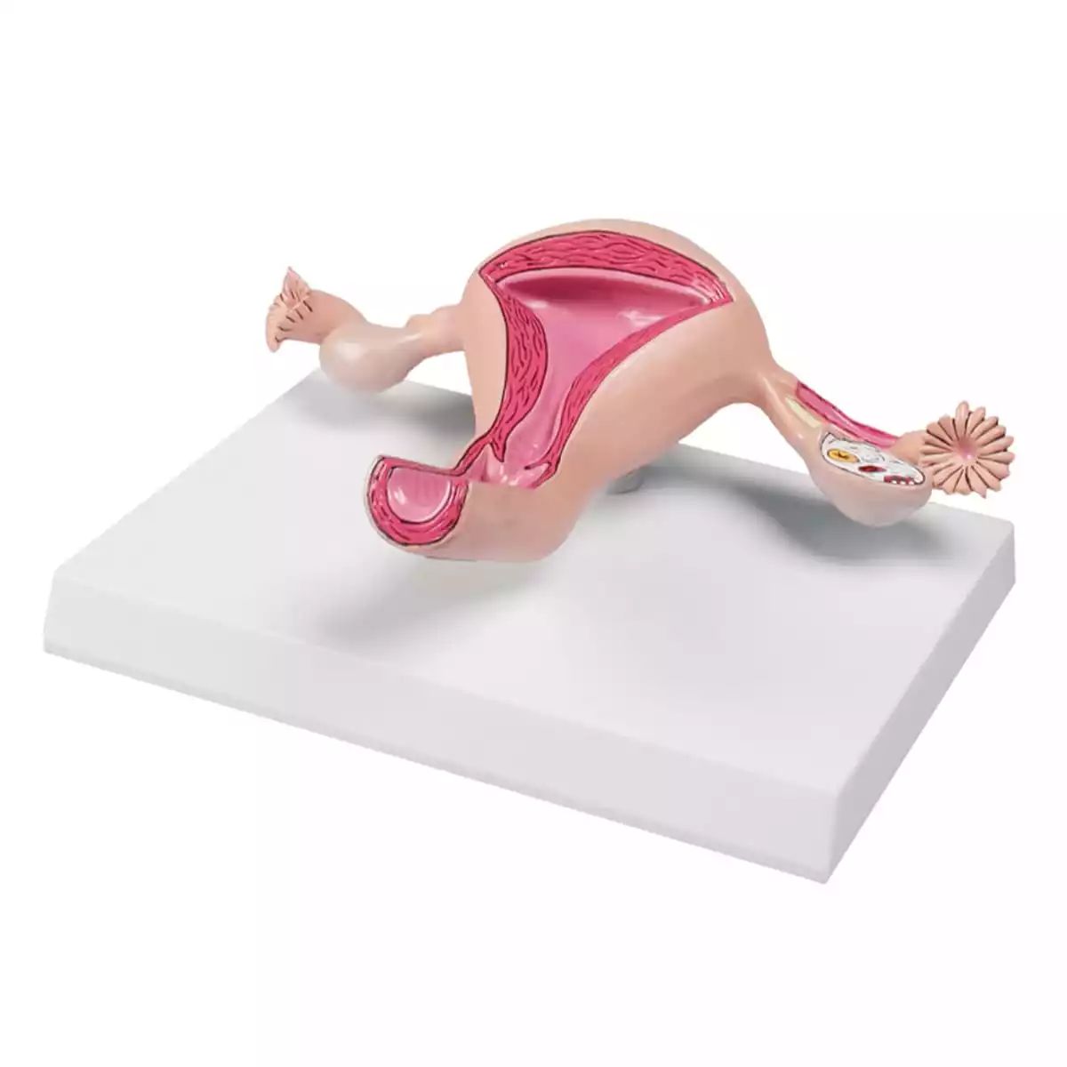  Baarmoedermodel