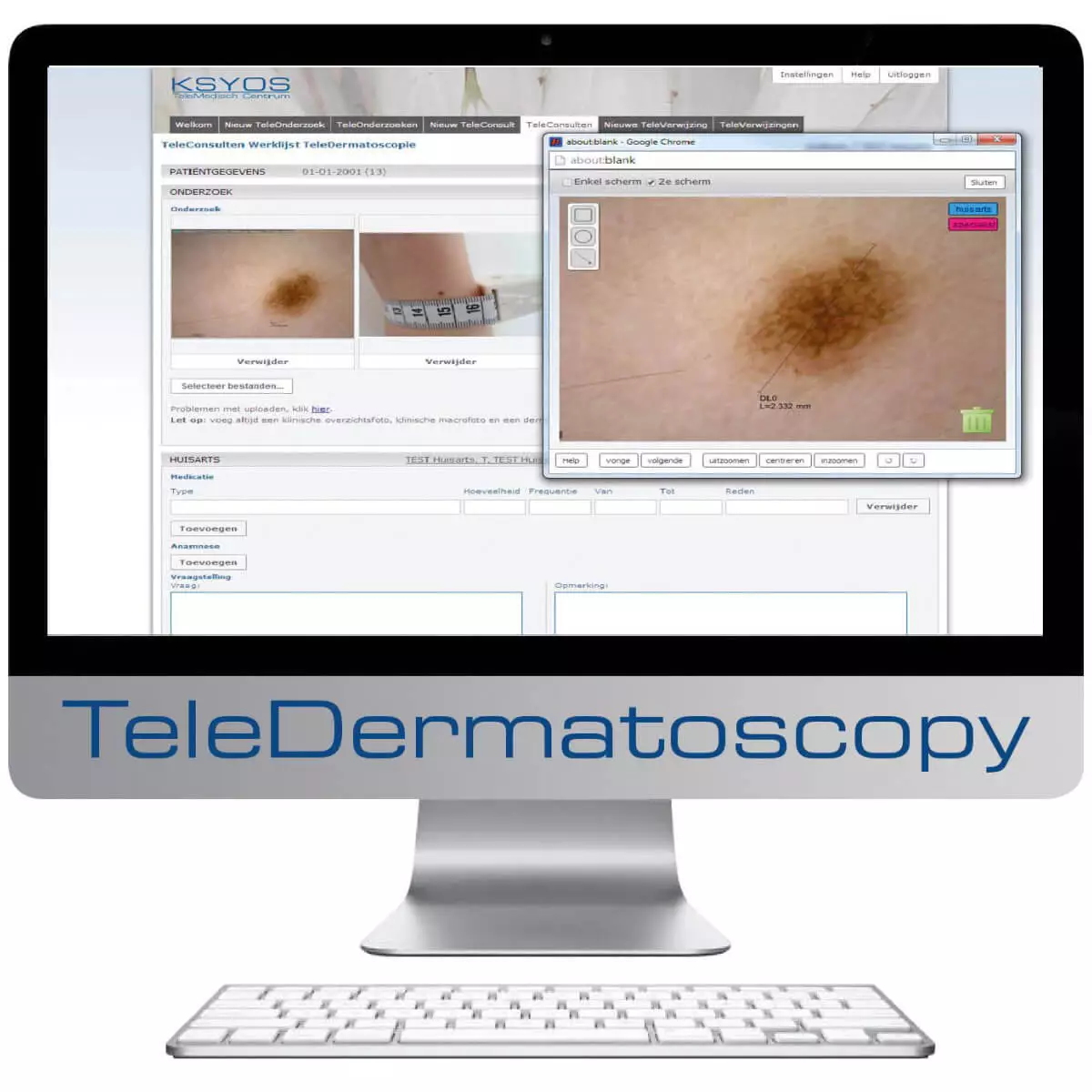  DermaScope Polarizer HR 200x videodermatoscoop