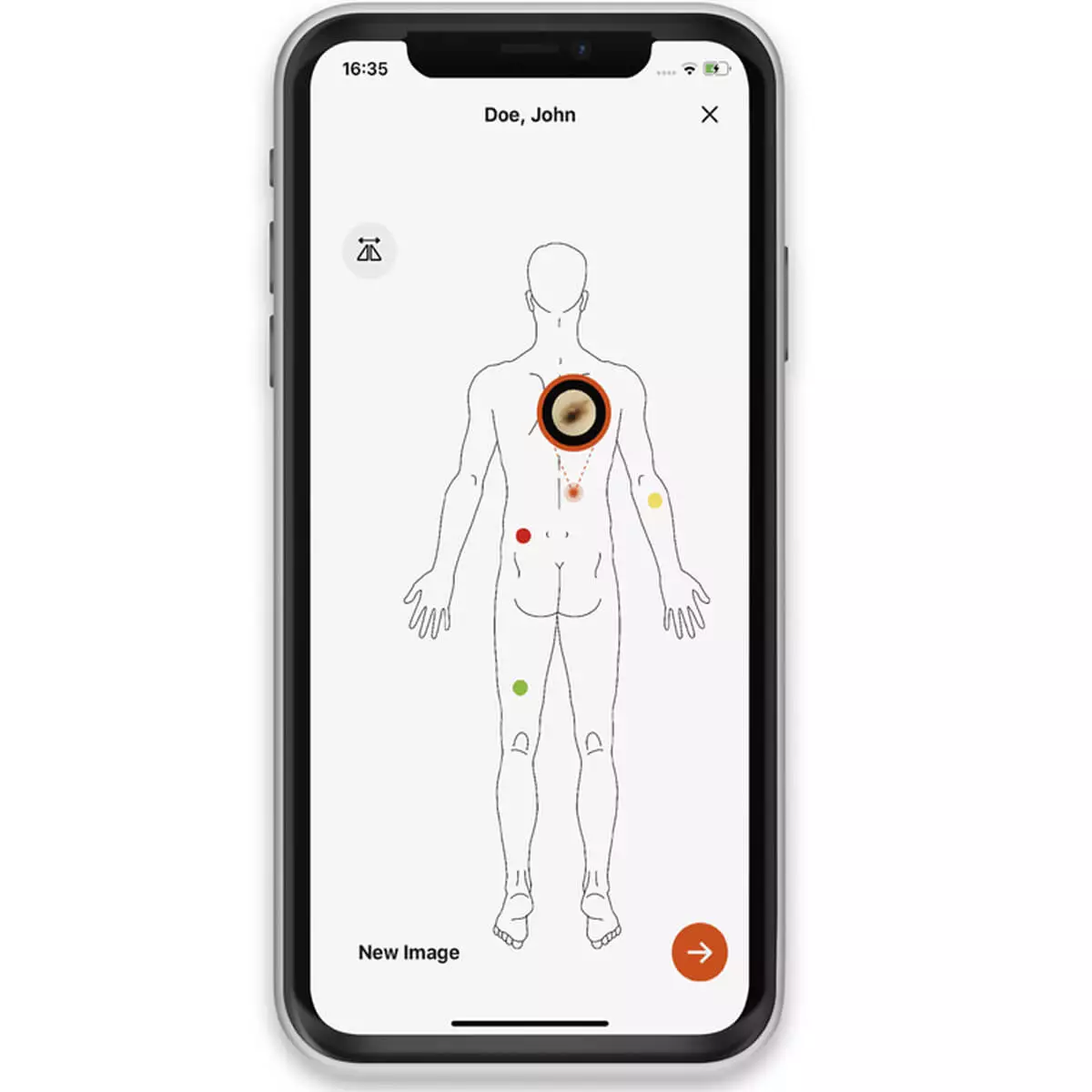  Coque d’adaptateur smartphone HEINE NC2